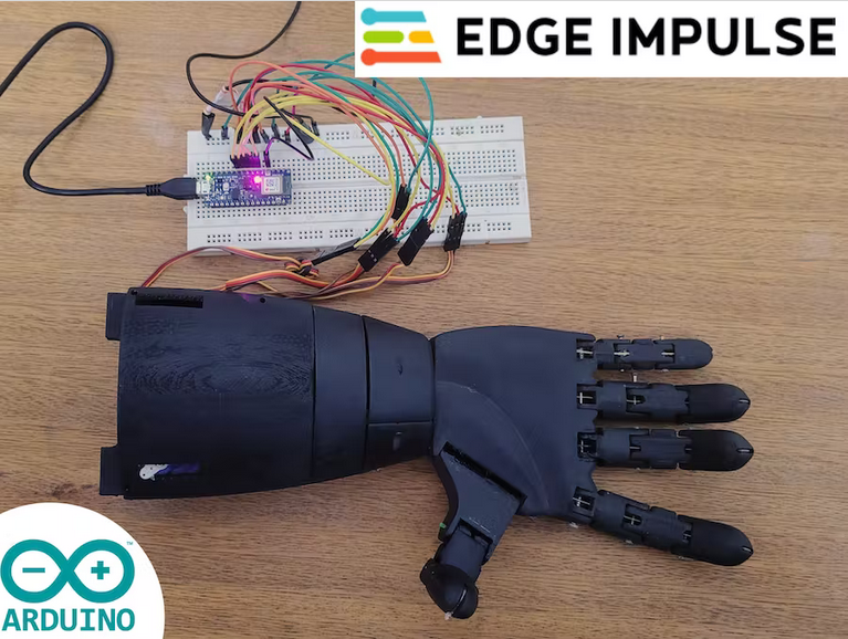The bionic hand with Arduino Nano 33 BLE Sense